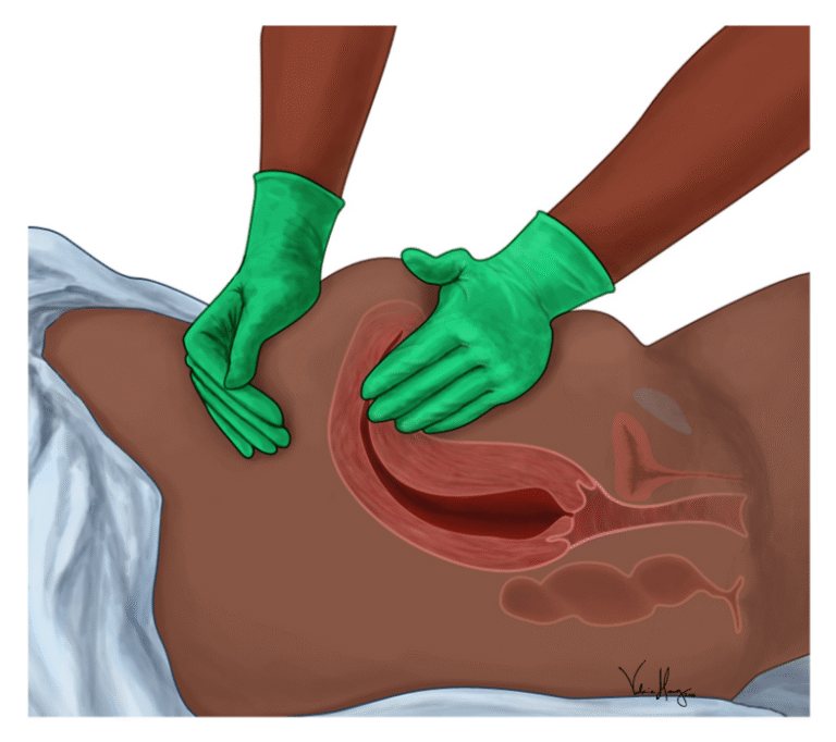 3 Common Gynecological Procedures