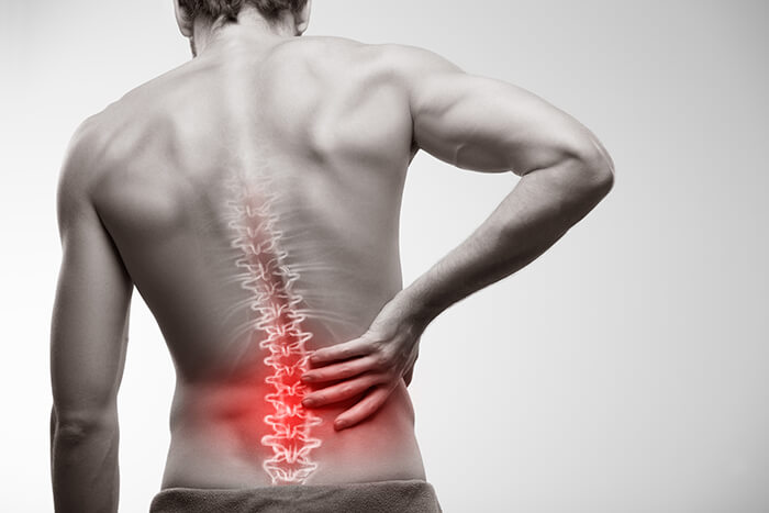3 Reasons to See a Doctor for Back Pain