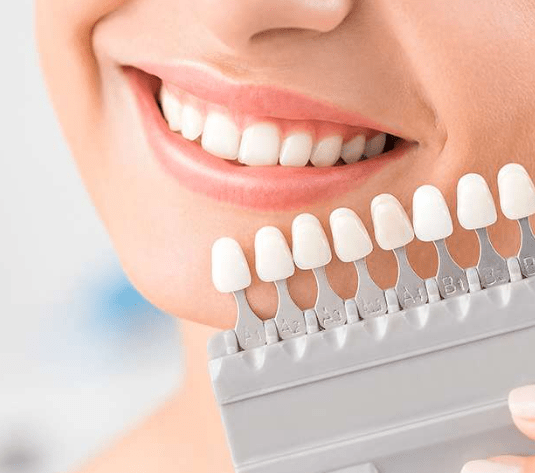 Caring for Your Veneers: Tips to Maintain a Radiant Smile