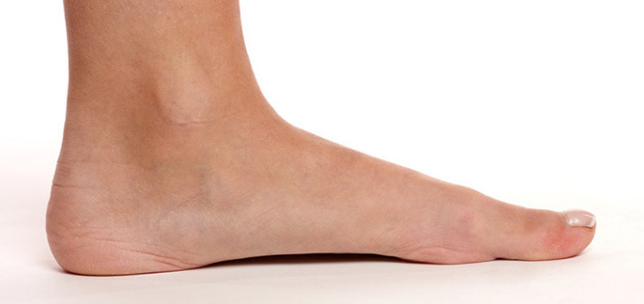 Flat Feet and How to Find the Right Footwear for Support