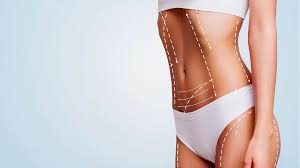 How Liposuction Can Help You Achieve Your Ideal Body Shape