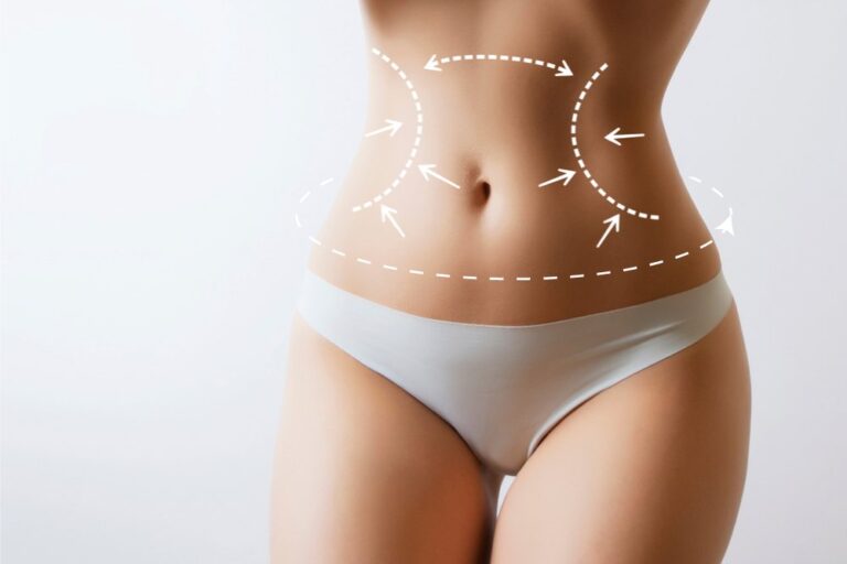 How Liposuction Targets Stubborn Fat for Lasting Results