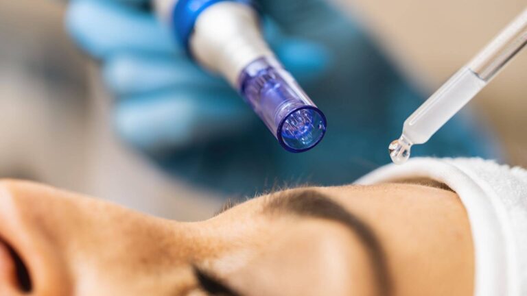 How Microneedling Can Enhance Your Skincare Routine