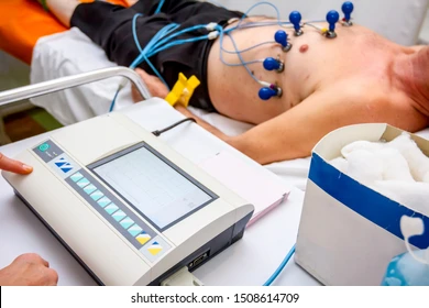What To Expect From a Cardiovascular Screening