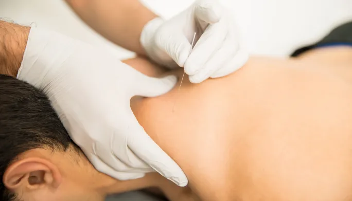 Acupuncture and The Future of Neurology