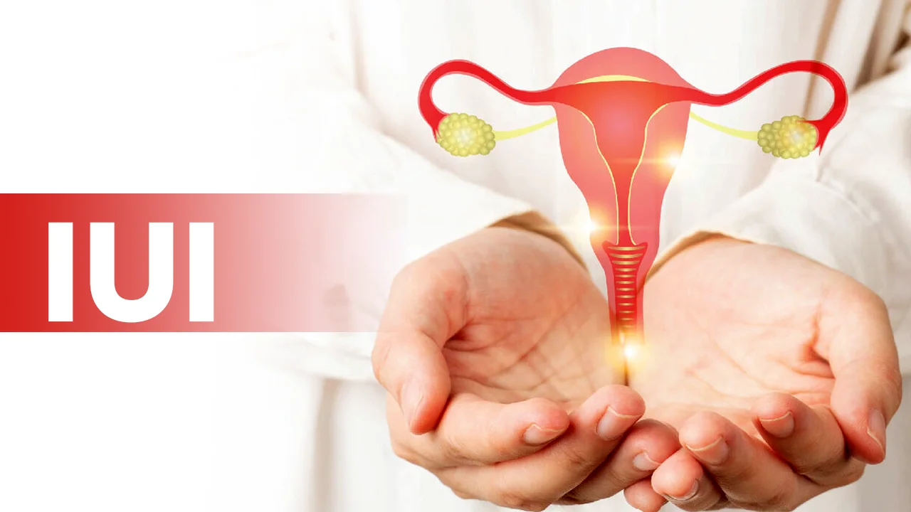How IUI Works for Infertility