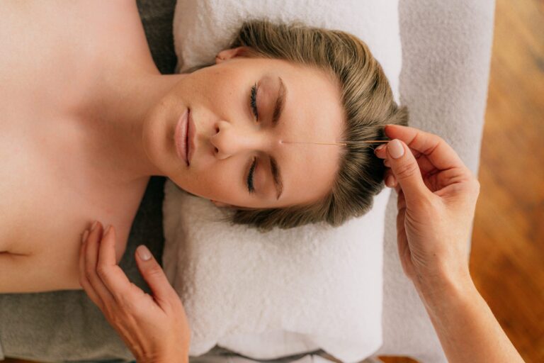 What Are the Benefits of Acupuncture for Mental Well-Being?