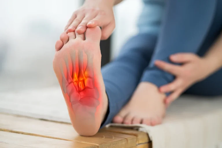 When Should I See a Doctor About Plantar Fasciitis?