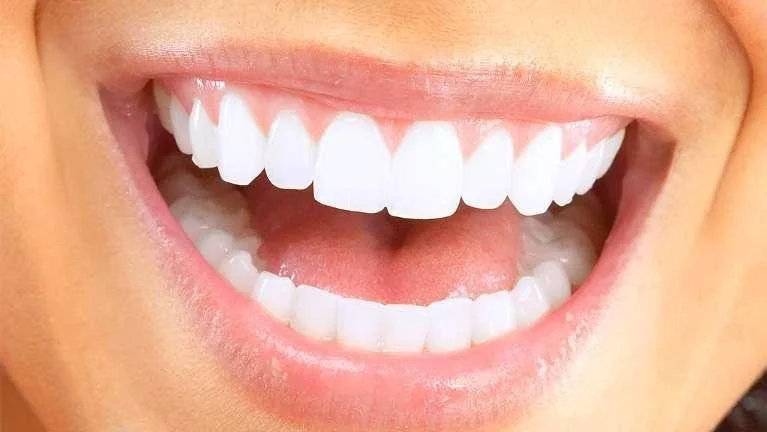 Enhancing Your Smile with Veneers