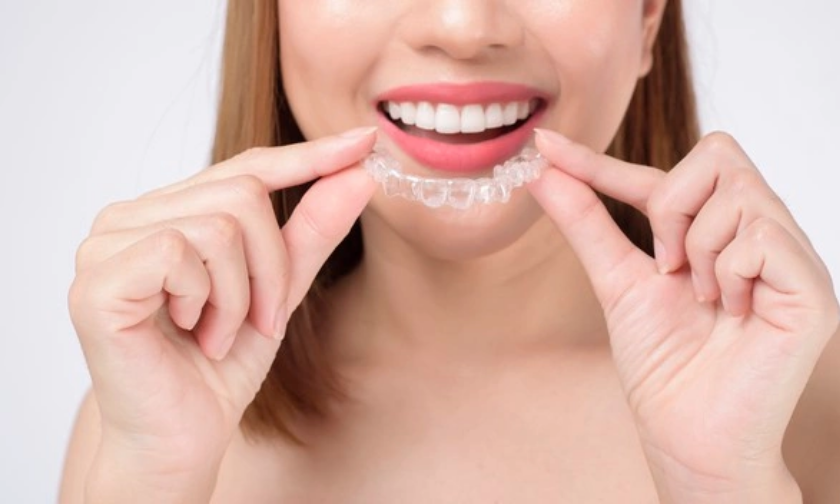 How Invisalign Clear Aligner Treatments Work