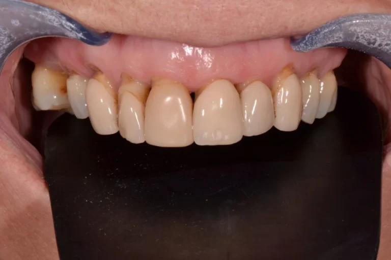 The Latest Innovations in Cosmetic Dentistry Techniques